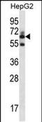 Gamma-Glutamyltransferase 2 antibody, PA5-48465, Invitrogen Antibodies, Western Blot image 
