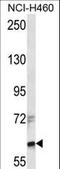 Zinc finger X-chromosomal protein antibody, LS-C160783, Lifespan Biosciences, Western Blot image 