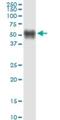 Transmembrane Serine Protease 5 antibody, H00080975-M09, Novus Biologicals, Western Blot image 