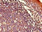 Activating Signal Cointegrator 1 Complex Subunit 1 antibody, LS-C375265, Lifespan Biosciences, Immunohistochemistry paraffin image 