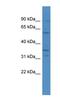 Carbonic Anhydrase 5A antibody, NBP1-68889, Novus Biologicals, Western Blot image 