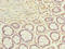 Actin Related Protein T1 antibody, LS-C375131, Lifespan Biosciences, Immunohistochemistry paraffin image 