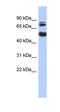 Coiled-Coil Domain Containing 151 antibody, orb325787, Biorbyt, Western Blot image 