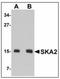 Spindle And Kinetochore Associated Complex Subunit 2 antibody, AP23903PU-N, Origene, Western Blot image 