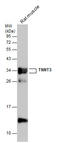 Troponin T3, Fast Skeletal Type antibody, GTX130922, GeneTex, Western Blot image 