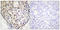 DNA Damage Inducible Transcript 3 antibody, LS-C198799, Lifespan Biosciences, Immunohistochemistry paraffin image 