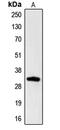 Cell Growth Regulator With EF-Hand Domain 1 antibody, MBS820934, MyBioSource, Western Blot image 