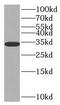 Sulfotransferase Family 1E Member 1 antibody, FNab08382, FineTest, Western Blot image 