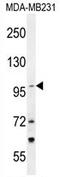 Tetratricopeptide Repeat Domain 16 antibody, AP54393PU-N, Origene, Western Blot image 