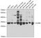Interleukin-20 receptor subunit beta antibody, GTX33262, GeneTex, Western Blot image 