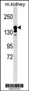 ATP Binding Cassette Subfamily C Member 9 antibody, 59-820, ProSci, Western Blot image 