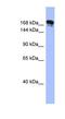 Synaptojanin 1 antibody, NBP1-57368, Novus Biologicals, Western Blot image 