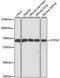 Synoviolin 1 antibody, STJ25765, St John