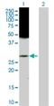 RAB43, Member RAS Oncogene Family antibody, H00339122-D01P, Novus Biologicals, Western Blot image 