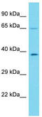 Keratin 73 antibody, TA331581, Origene, Western Blot image 