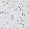 Pyruvate Dehyrogenase Phosphatase Catalytic Subunit 1 antibody, LS-C334646, Lifespan Biosciences, Immunohistochemistry frozen image 