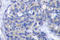 Zeta Chain Of T Cell Receptor Associated Protein Kinase 70 antibody, LS-C177646, Lifespan Biosciences, Immunohistochemistry paraffin image 