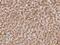 Cathepsin B antibody, GTX02305, GeneTex, Immunohistochemistry paraffin image 