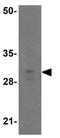 Tissue Factor Pathway Inhibitor antibody, GTX31885, GeneTex, Western Blot image 