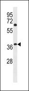 NHL Repeat Containing 3 antibody, LS-C157998, Lifespan Biosciences, Western Blot image 