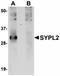 Synaptophysin Like 2 antibody, orb75234, Biorbyt, Western Blot image 
