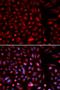 Axin 2 antibody, orb167175, Biorbyt, Immunocytochemistry image 