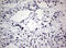 Actin Filament Associated Protein 1 antibody, M05258, Boster Biological Technology, Immunohistochemistry paraffin image 