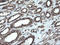 Protein Disulfide Isomerase Family A Member 3 antibody, LS-C174089, Lifespan Biosciences, Immunohistochemistry paraffin image 