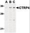 Complement C1q tumor necrosis factor-related protein 4 antibody, orb86701, Biorbyt, Western Blot image 