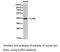 Interleukin 2 Receptor Subunit Gamma antibody, LS-C193031, Lifespan Biosciences, Western Blot image 