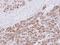 Proteasome Subunit Alpha 3 antibody, LS-C186309, Lifespan Biosciences, Immunohistochemistry paraffin image 