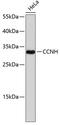 Cyclin H antibody, 13-035, ProSci, Western Blot image 