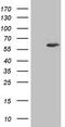 IKAROS Family Zinc Finger 3 antibody, M01611-1, Boster Biological Technology, Western Blot image 
