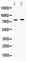 Acyl-CoA Synthetase Long Chain Family Member 5 antibody, PA5-78714, Invitrogen Antibodies, Western Blot image 