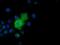 Adenylate Kinase 5 antibody, GTX84921, GeneTex, Immunofluorescence image 