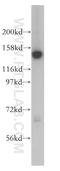 SIN3 Transcription Regulator Family Member A antibody, 14638-1-AP, Proteintech Group, Western Blot image 