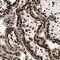 AT-Rich Interaction Domain 3A antibody, NBP1-89938, Novus Biologicals, Immunohistochemistry frozen image 