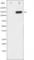 Phospholipase C Gamma 1 antibody, abx011722, Abbexa, Western Blot image 