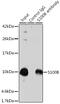 S100 Calcium Binding Protein B antibody, GTX57757, GeneTex, Immunoprecipitation image 