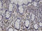 NME/NM23 Nucleoside Diphosphate Kinase 6 antibody, LS-C134018, Lifespan Biosciences, Immunohistochemistry paraffin image 