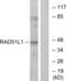 RAD51 Paralog B antibody, LS-C119591, Lifespan Biosciences, Western Blot image 