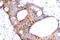 Glycogen Synthase Kinase 3 Alpha antibody, LS-C177904, Lifespan Biosciences, Immunohistochemistry paraffin image 