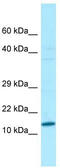 Testis-specific basic protein Y 1 antibody, TA338178, Origene, Western Blot image 