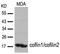 CFL1 antibody, AP08086PU-S, Origene, Western Blot image 
