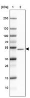 Gamma-Aminobutyric Acid Type A Receptor Alpha1 Subunit antibody, PA5-63170, Invitrogen Antibodies, Western Blot image 