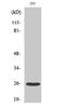 Tetraspanin 8 antibody, STJ95974, St John