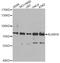 AlkB Homolog 8, TRNA Methyltransferase antibody, A7142, ABclonal Technology, Western Blot image 