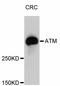 ATM Serine/Threonine Kinase antibody, abx125295, Abbexa, Western Blot image 