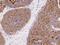 Polymorphic epithelial mucin antibody, 12123-R107, Sino Biological, Immunohistochemistry frozen image 