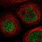 Scm Polycomb Group Protein Like 1 antibody, NBP1-86309, Novus Biologicals, Immunofluorescence image 